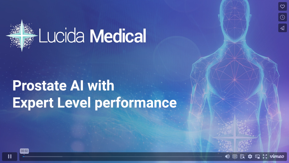 Find cancer quickly & efficiently with MRI and artificial intelligence (AI)