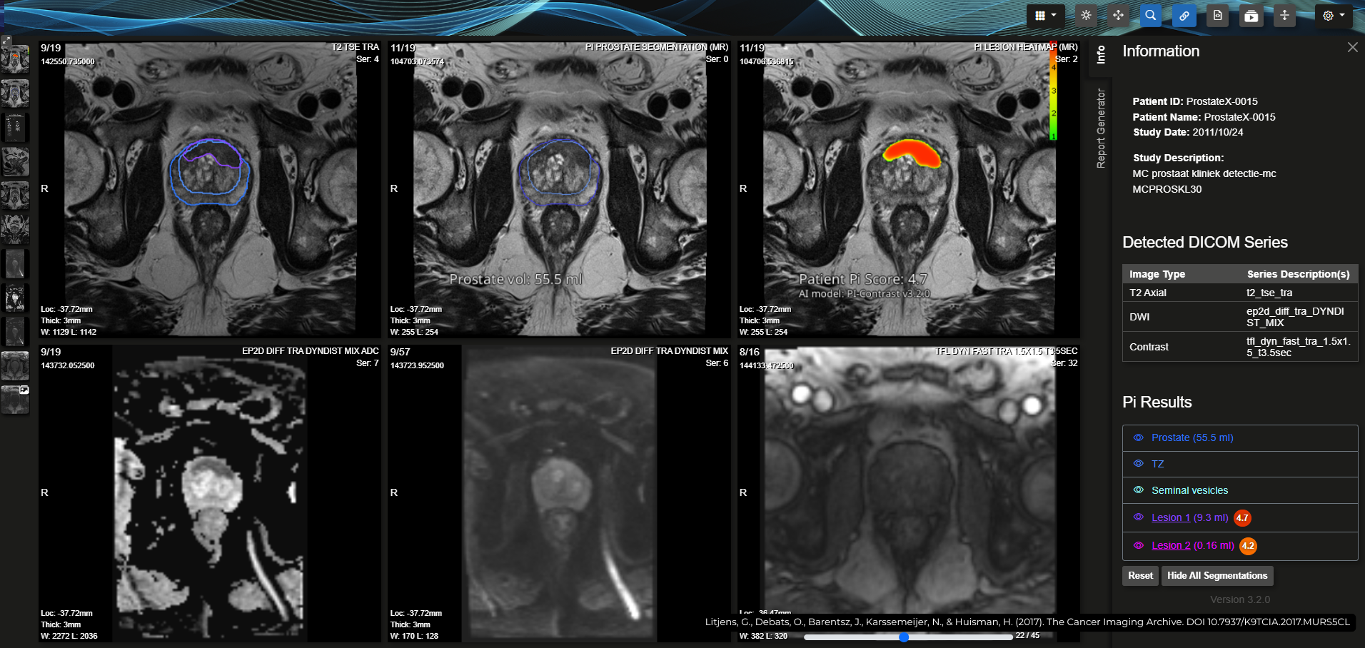 £8.7m funding from IW capital, XTX markets, Macmillan cancer support